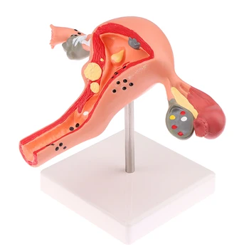 1buc Medicale Recuzită Model Patologic Uter Ovar Anatomice Model de Anatomie Secțiune Transversală Instrument de Studiu