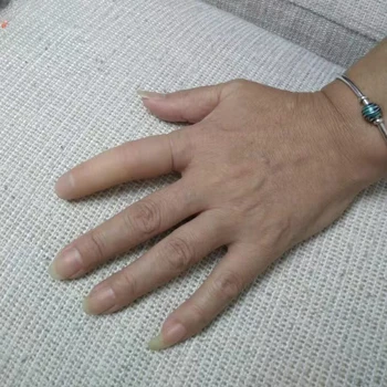 High-End De Silicon Degetul Proteza Cu Handicap Simulare Toe Acoperi Jumătate De Deget